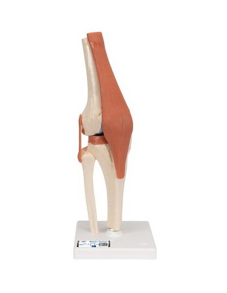 Zglob koljena, funkcionalni s ligamentima i hrskavicom