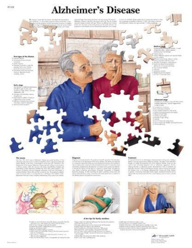 Alzheimerova bolest (1628)