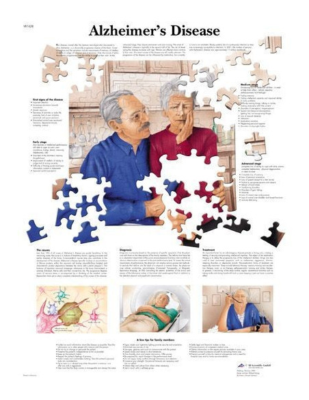 Alzheimerova bolest (1628)