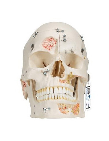 Lubanja deluxe 10 dijelova