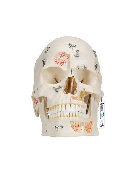 Lubanja deluxe 10 dijelova