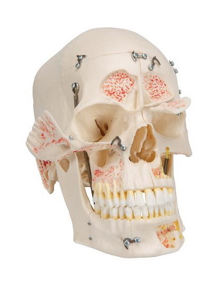 Lubanja deluxe 10 dijelova