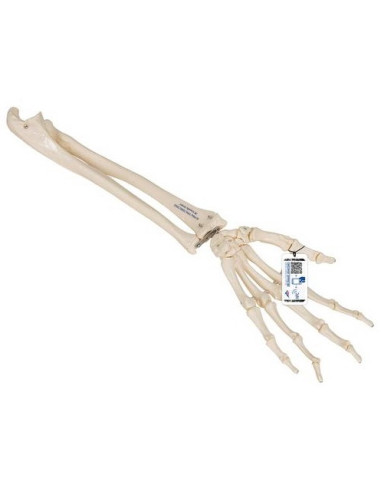 Kosti ruke - podlaktica