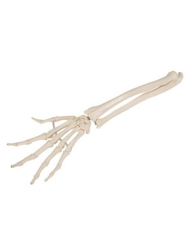 Kosti ruke - podlaktica