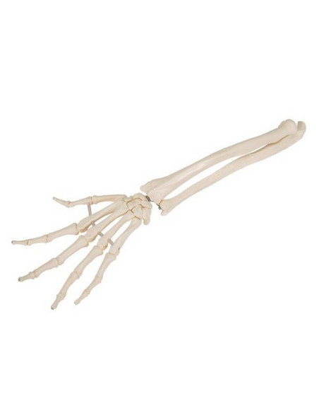 Kosti ruke - podlaktica