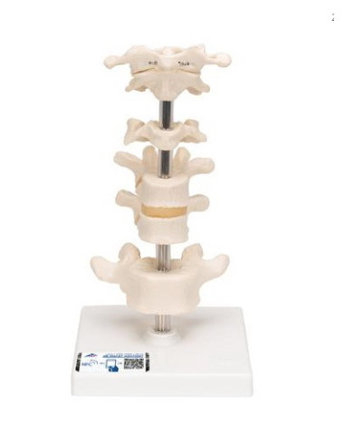 Set kralješaka na stalku