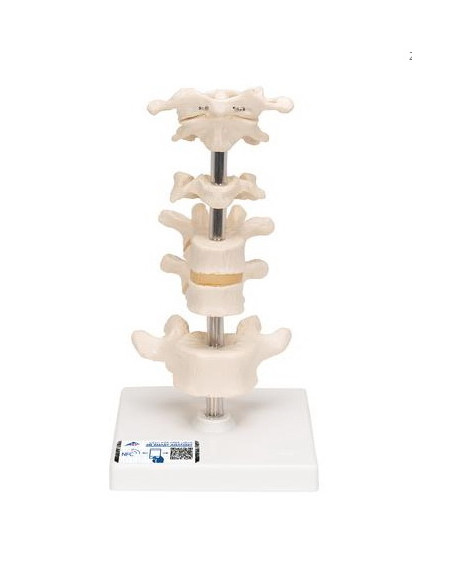 Set kralješaka na stalku