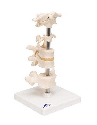 Set kralješaka na stalku