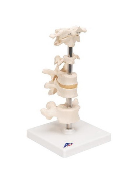 Set kralješaka na stalku