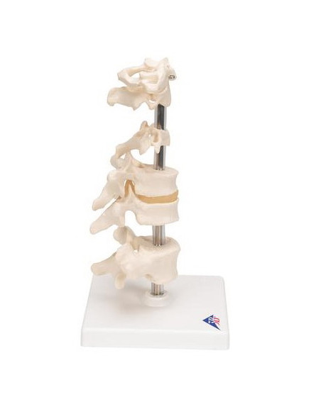 Set kralješaka na stalku