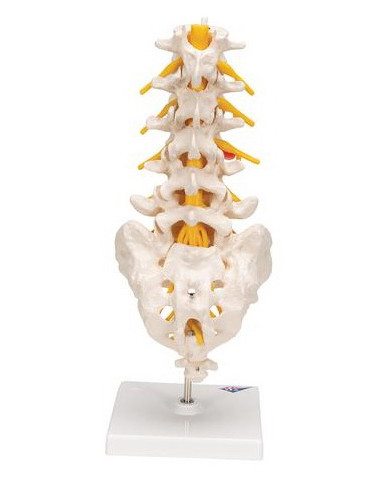 Lumbalna kralježnica+prolapsa