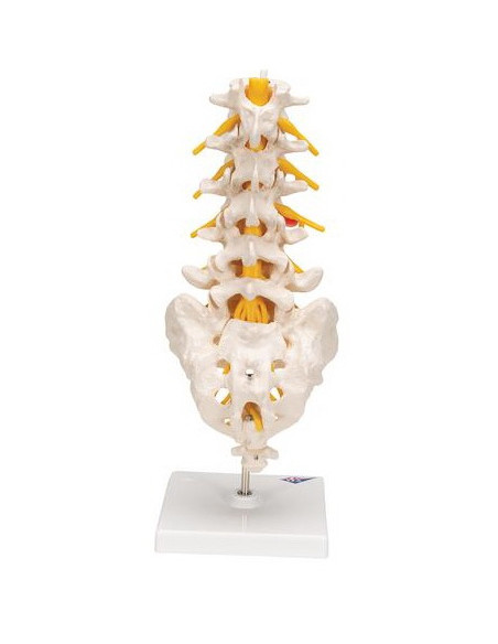 Lumbalna kralježnica+prolapsa