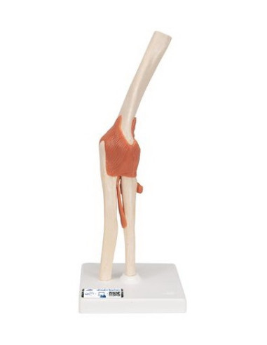 Zglob lakta s ligamentima i hrskavicom