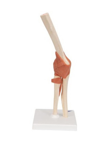 Zglob lakta s ligamentima i hrskavicom