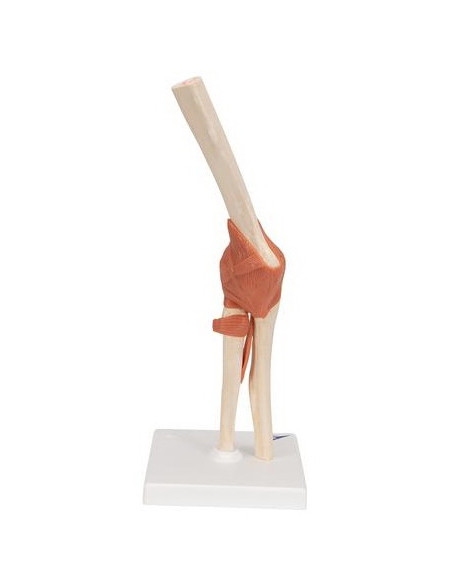 Zglob lakta s ligamentima i hrskavicom