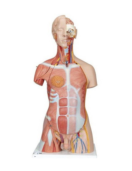 Torzo deluxe, 31 dio