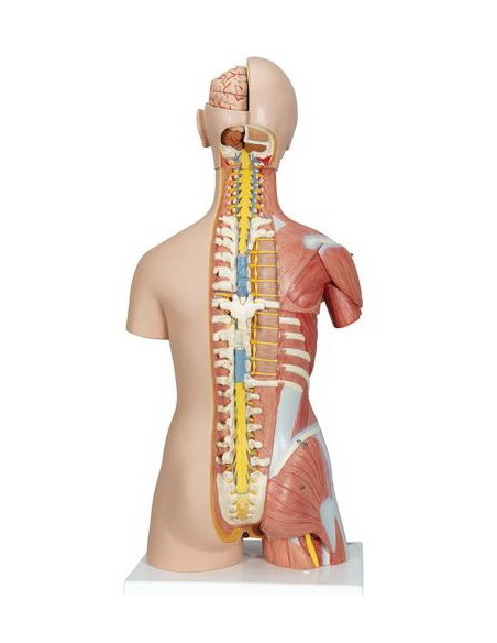 Torzo deluxe, 31 dio