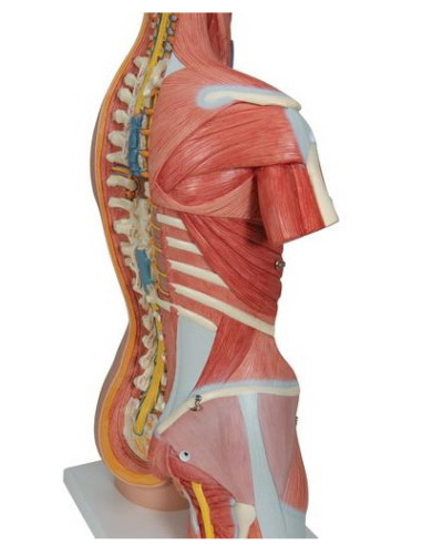 Torzo deluxe, 31 dio