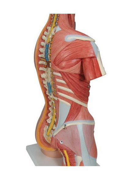 Torzo deluxe, 31 dio