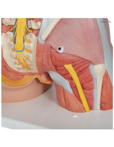 Torzo deluxe, 31 dio