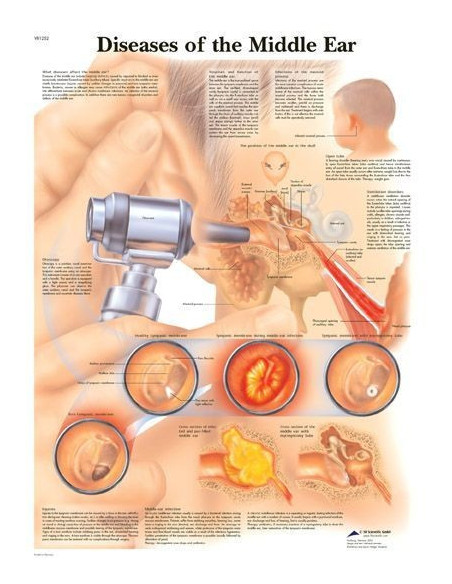 Rinitis i sinusitis (1251)