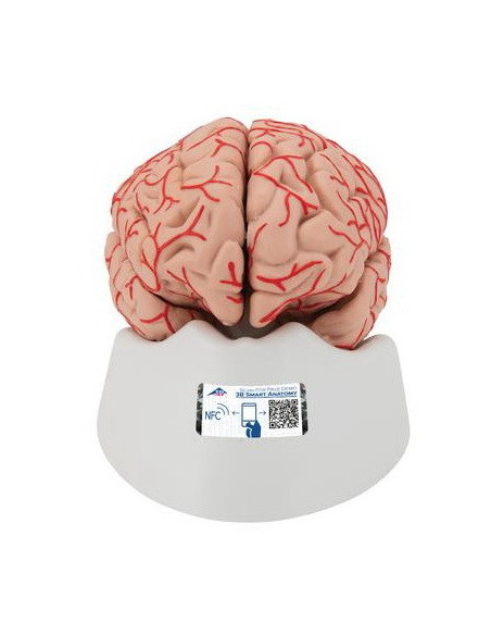 Mozak sa arterijama 9 dijelova