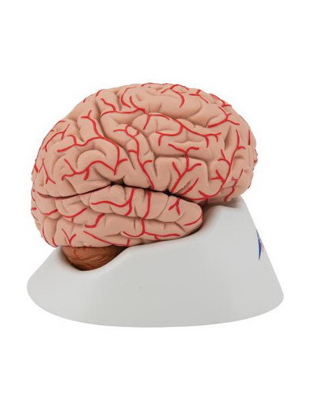 Mozak sa arterijama 9 dijelova