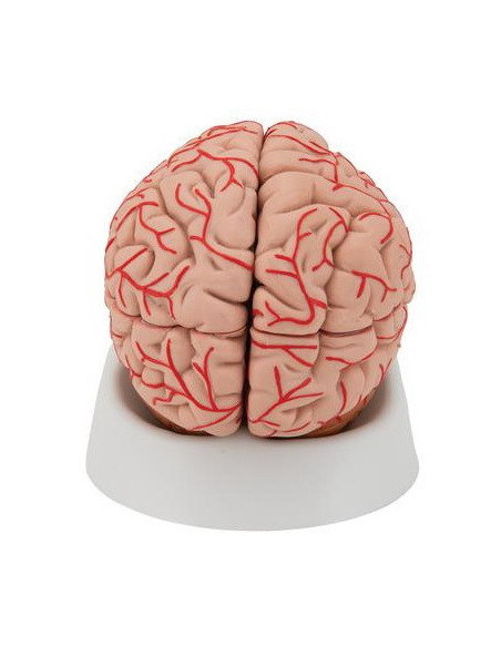 Mozak sa arterijama 9 dijelova