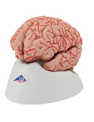 Mozak sa arterijama 9 dijelova