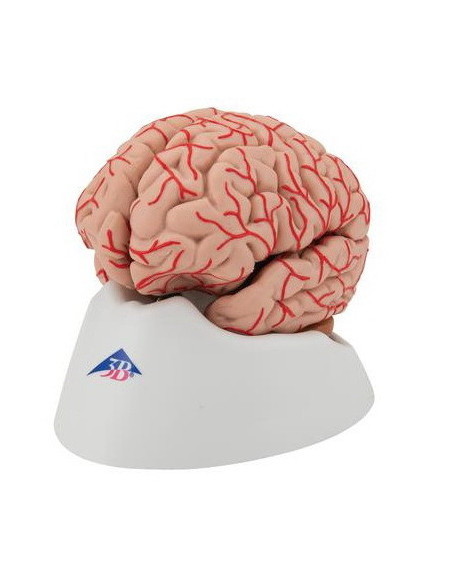 Mozak sa arterijama 9 dijelova