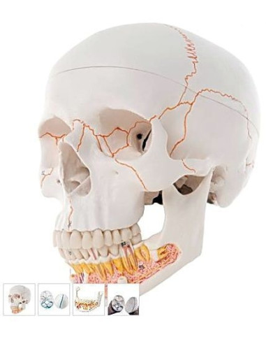 Lubanja s otvorenom čeljusti