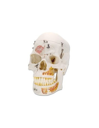 Lubanja deluxe 10 dijelova