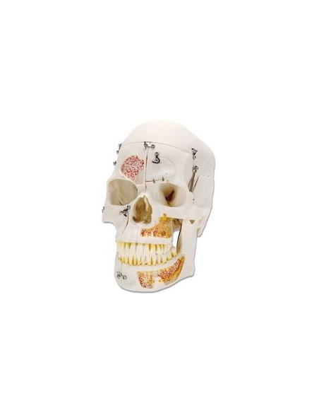 Lubanja deluxe 10 dijelova