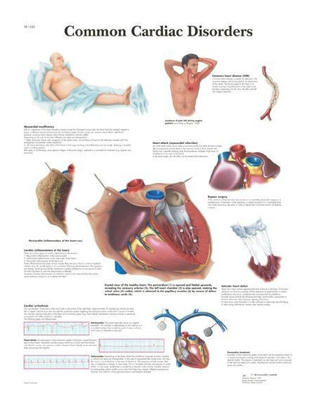 Kardiološki poremećaji (1343)