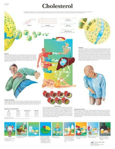 Kolesterol (1452)
