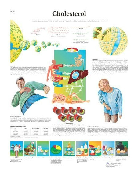 Kolesterol (1452)
