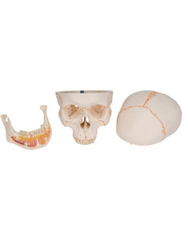 Lubanja s otvorenom čeljusti