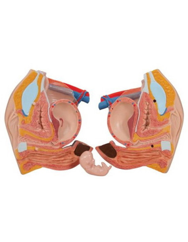 Torzo deluxe, 31 dio