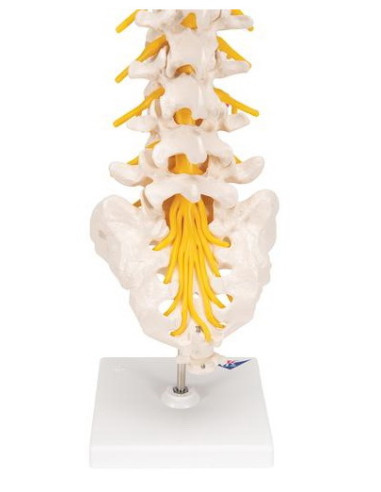 Lumbalna kralježnica+prolapsa