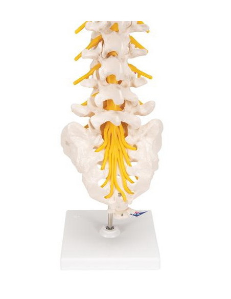 Lumbalna kralježnica+prolapsa