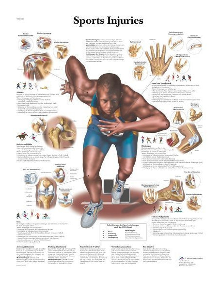 Sportske povrede (1188)