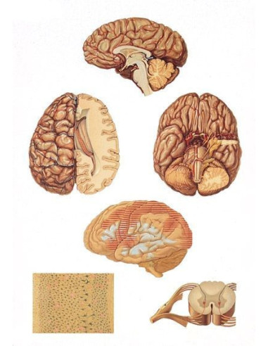 Središnji živč. sustav (2034)